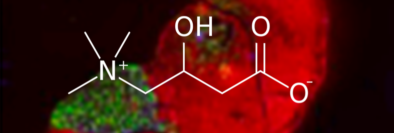 Carnitine (Part 2):  Elevated Muscle Loading via Muscle Contraction and Caffeine Co-ingestion.